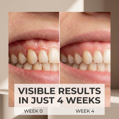 Protect your gums from inflammation and gingivitis with Blettea