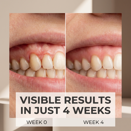 Protect your gums from inflammation and gingivitis with Blettea